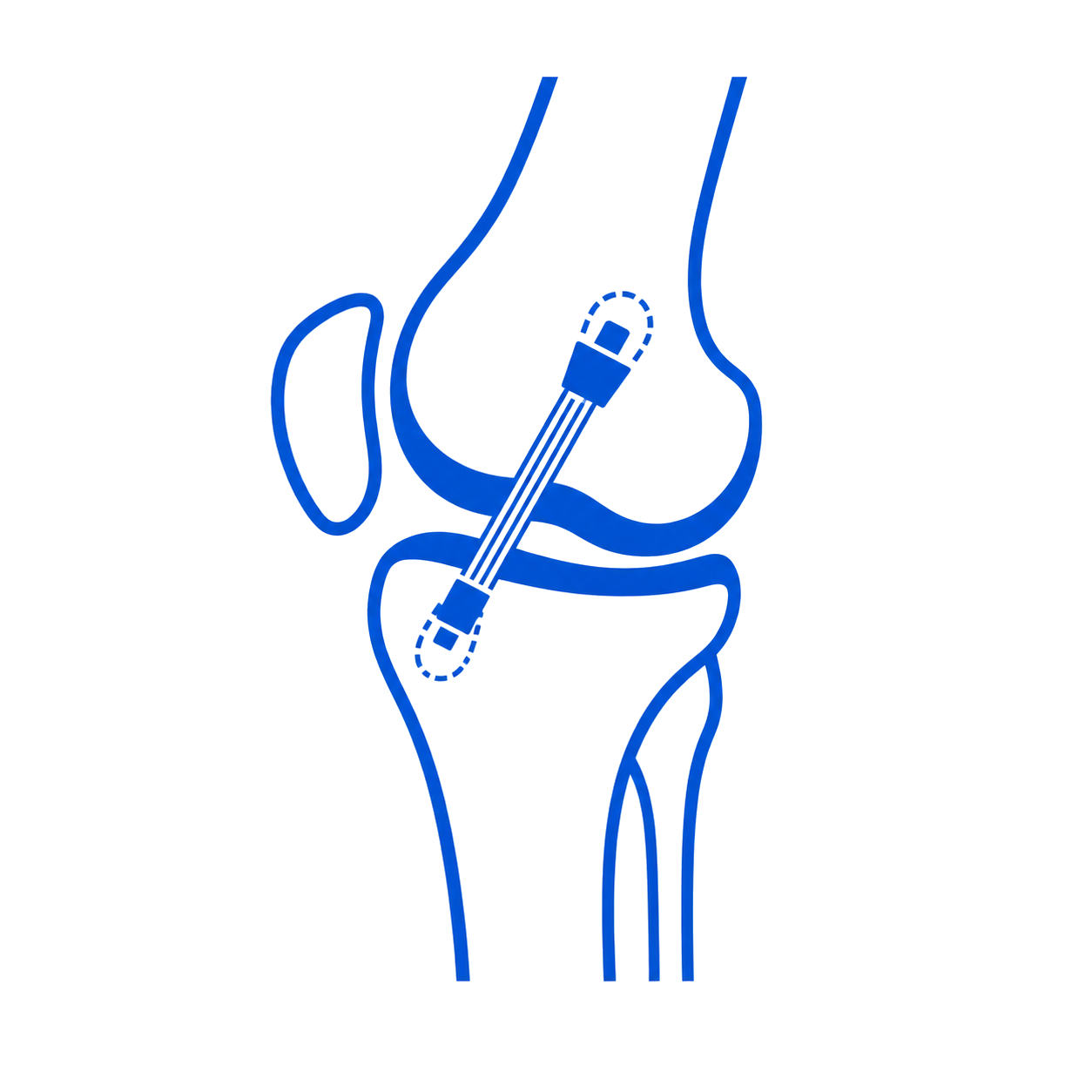 ACL Reconstruction icon